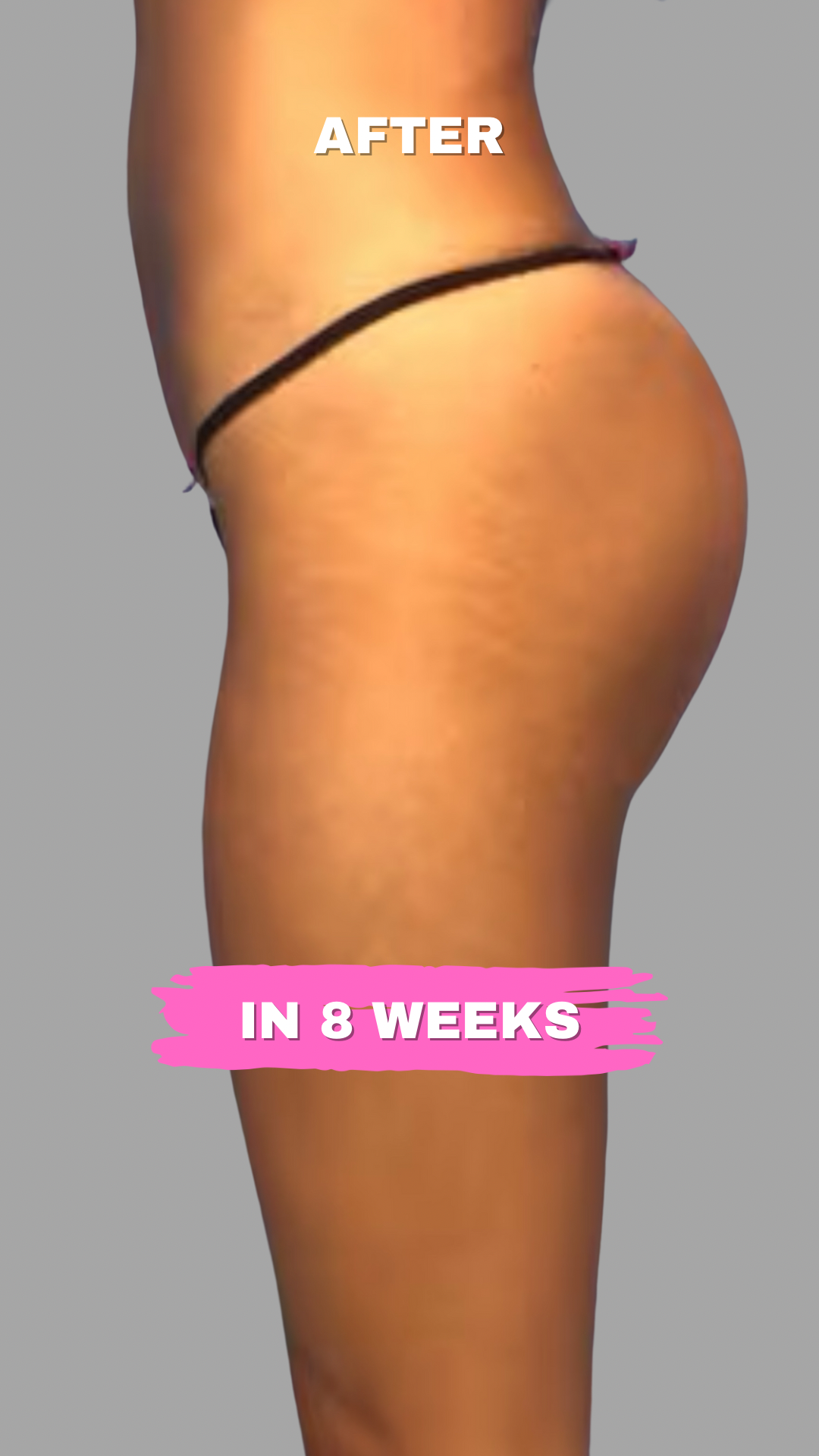 Yellow and Black Grunge Self-love Motivational Phone Wallpaper